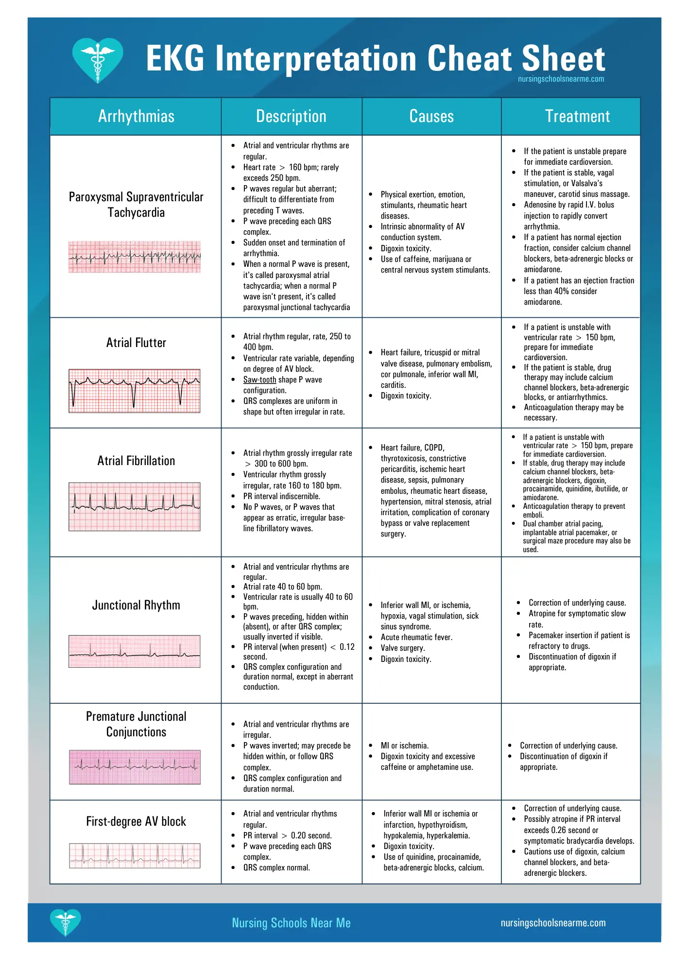 EKG Interpretation Cheat Sheet PDF
