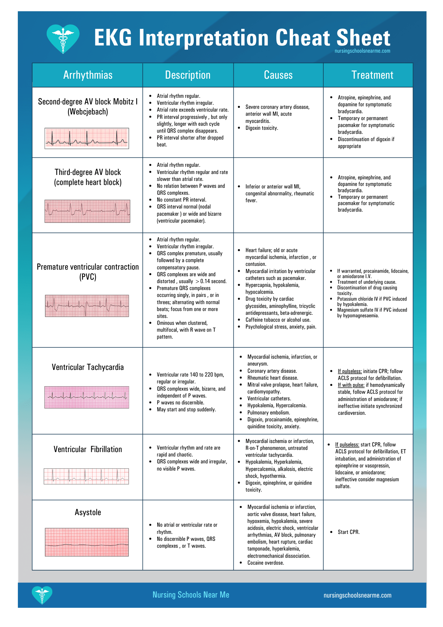 EKG Interpretation Cheat Sheet - Nursing Schools Near Me