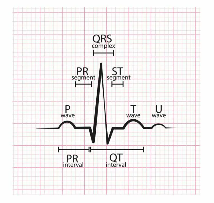 PR Interval: A Comprehensive Guide - Nursing Schools Near Me