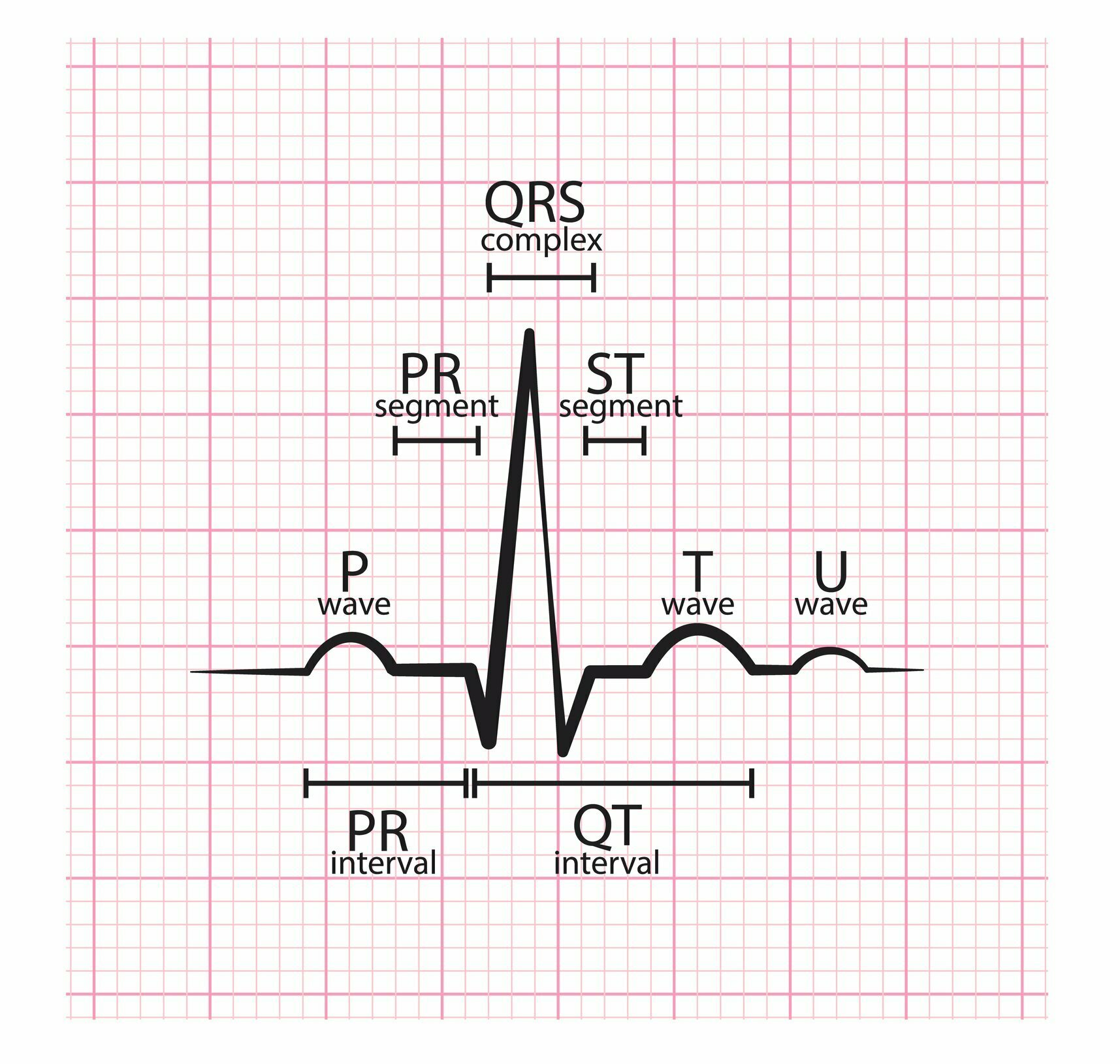 Ecg Pr Interval Normal Range In Ms - Printable Templates Protal