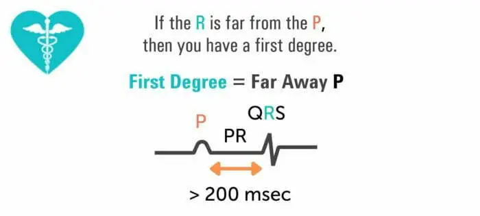 first-degree-far-away-p