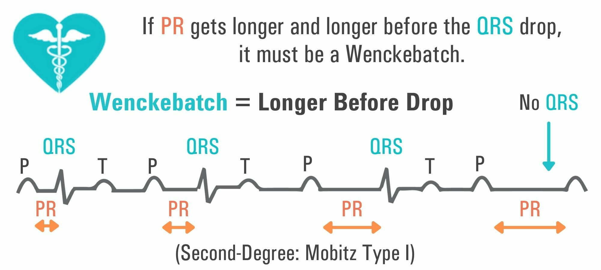 PR Interval: A Comprehensive Guide - Nursing Schools Near Me