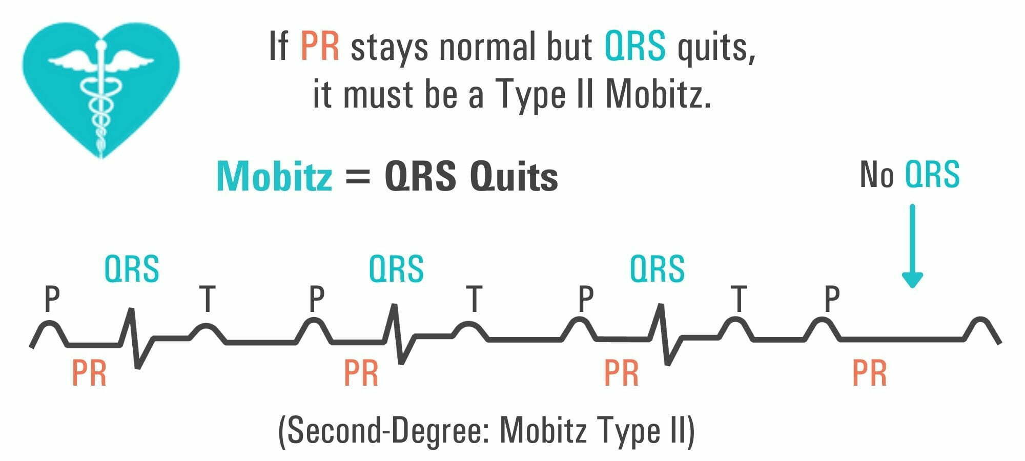 PR Interval: A Comprehensive Guide - Nursing Schools Near Me