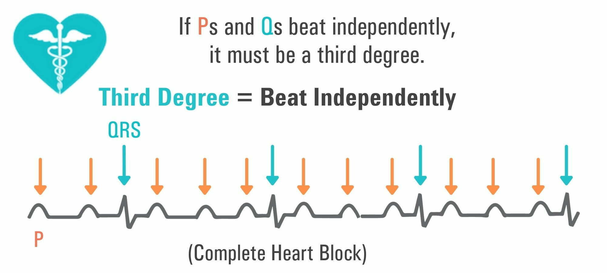 PR Interval: A Comprehensive Guide - Nursing Schools Near Me