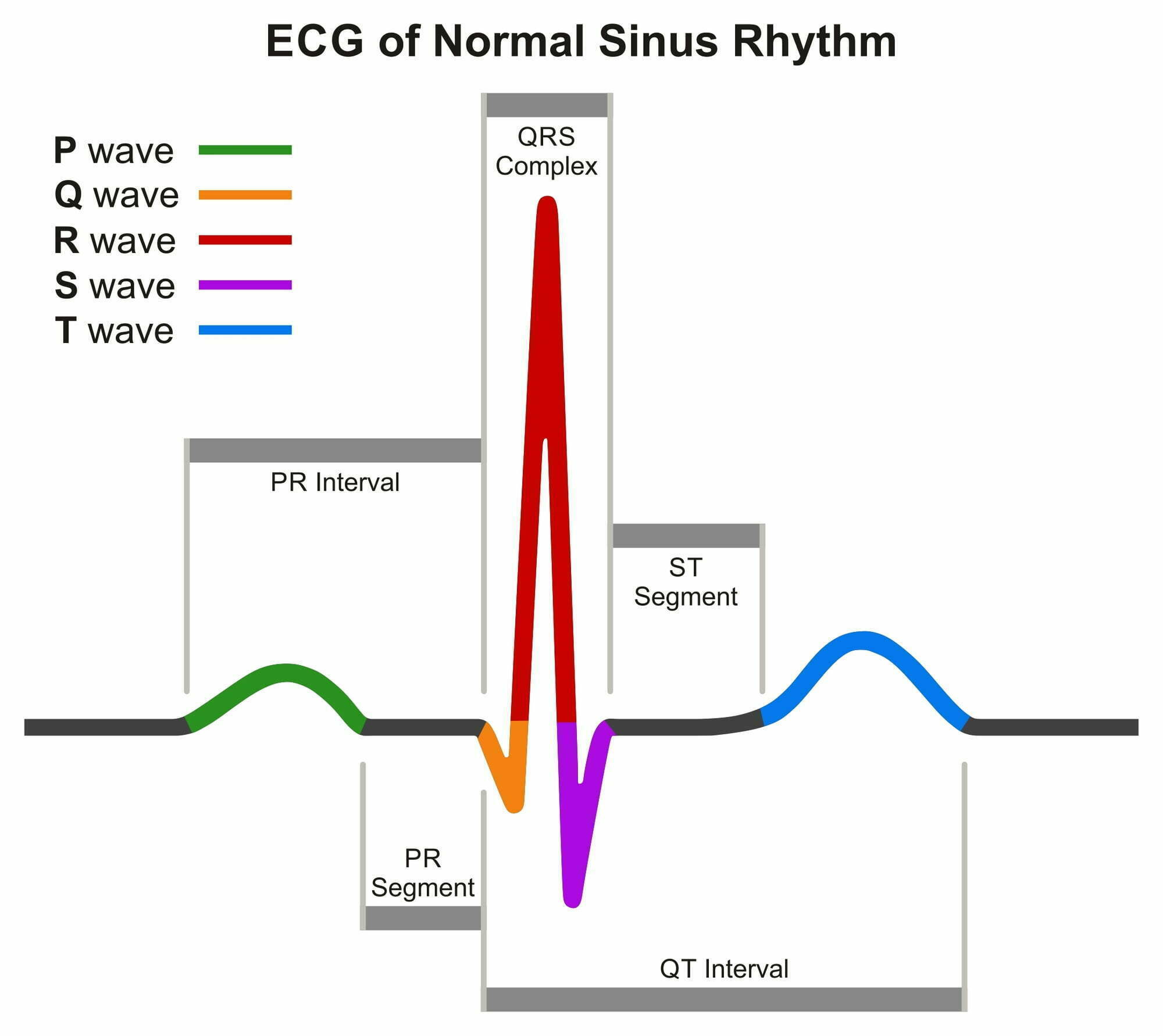 pr-interval-a-comprehensive-guide-nursing-schools-near-me